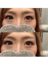 ビビ(VIVI)/バインドロック１００束