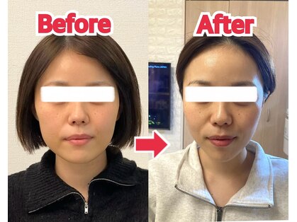 アスト(AST)の写真