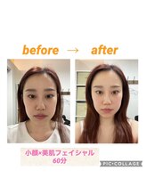 スリーズララ(Cerise LaLa)/