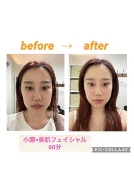 スリーズララ(Cerise LaLa)/