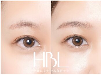 リンネ(Rinne)/【HBL】before/after