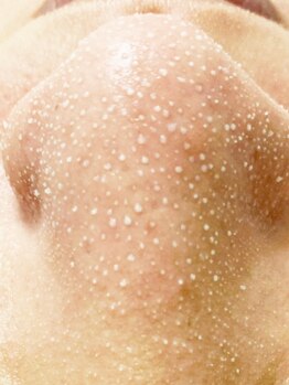 エイトビューティデザイン(eight beauty design)の写真/【SNSで話題★韓国式３D毛穴洗浄がオススメ◎】毛穴ケア特化メニュー充実！「質」にこだわる大人女性必見◎