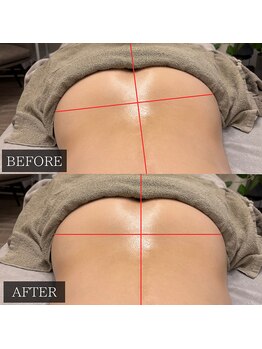 ツカ(TSUKA)/腰痛改善！