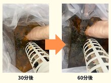 スズラン(SUZURAN)/ゴットクリーナー【60分後】