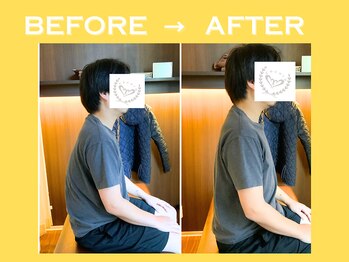 こころ整骨院/30代男性のビフォーアフター
