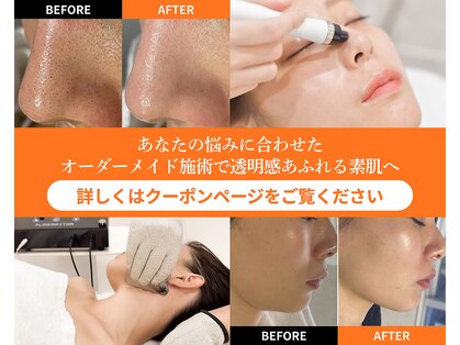 ハーボプラス(THE HEARBO plus)の写真