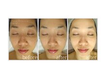 アン グレーヌ 自由が丘(unegraine)/バランスの取れたスベスベお肌！