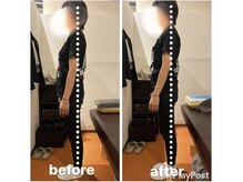 カワル整体 上通り院/【いつも右半身に痛みが出る..】