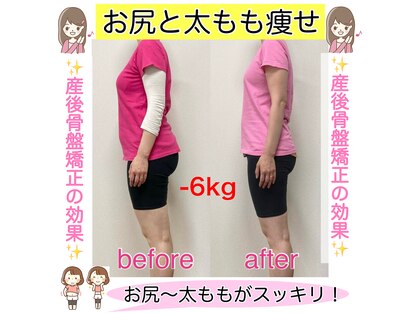 骨盤整体 サクラ(Sakura)の写真