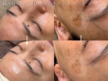 コアラル 麻布十番(COALALU)/CHRISTINA　イラストリアス