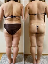 クレビア 吉祥寺店(CREBIA)/エンダモロジー/痩身/吉祥寺