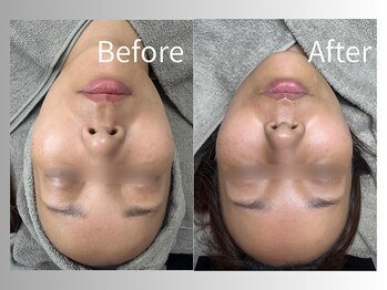 クレーヌ(CREINE)/プラズマ