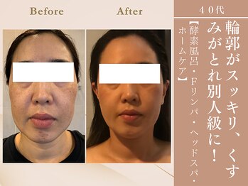 ケムズ インプルーブメントサロン(KMS IMPROVEMENT salon)/