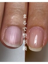 ロイヤル ネイルサロン(Royal nail Saloon)/自爪育成