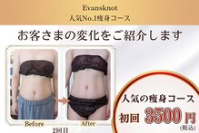 エバンス ノット(Evans knot)