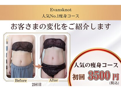 エバンス ノット(Evans knot)の写真