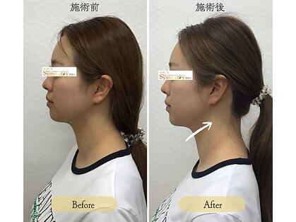 なさき整骨院プラスシンメトリー 豊橋店の写真