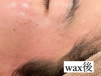 サロン ド ワカ(Salon de WAKA)/フェイシャルwax初回 施術後