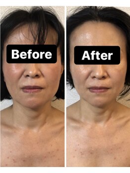 小顔コルギサロン シー(She)/【コルギ】1度の変化!