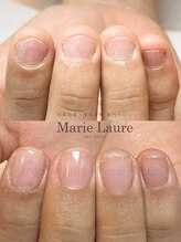 マリーロール 淀屋橋本店(Marie Laure)/自爪育成/深爪矯正/ネイルケア