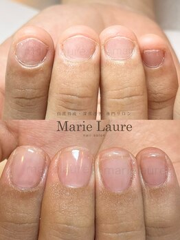 マリーロール 淀屋橋本店(Marie Laure)/自爪育成/深爪矯正/ネイルケア