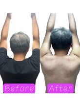 鍼の魔法 恵比寿院/首肩こり　施術回数:1回