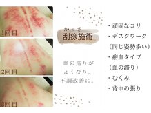 栖