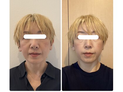 プラスハンド(+HAND)の写真