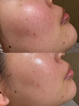 ウルソワン 都島店(/ulu soin)/赤みの改善