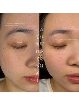 シエル 名駅店(Ciel)/〔垂れ眉改善！〕