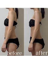 クレスト 山口店(Crest)/猫背気になる方へ｜1回での変化