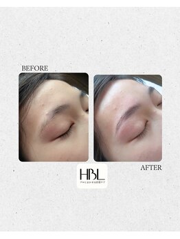 サンハート(SUN HEART)/大人気ハリウッドブロウリフト