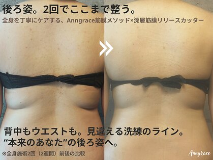 アングレイス(Anngrace)の写真