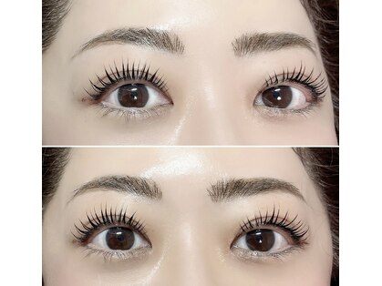 アイリス(EYELISS)の写真