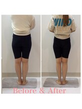 スタイルラボ高松/産後骨盤矯正の効果♪