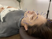 アットレスト(At rest)