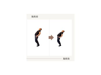 バレルメディカル研究所 恵比寿/急な腰痛でも・・・・