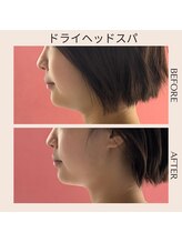 アルパカ(ALPAKA)/横顔の印象が変わる！