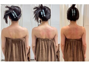 ロココ 豊田店(Rococo)/ビフォーアフター