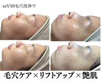 【毛穴洗浄・肌質改善専門】Beauty salon Iam
