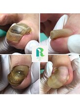 レイ(Ray)/どのお爪にも施術可能です！