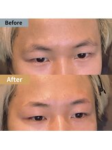 眉毛ハウス 吉祥寺店(眉毛HOUSE)/お客様の施術例(吉祥寺/東京)