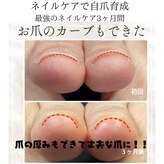 アクアリュース(Aquqrius)