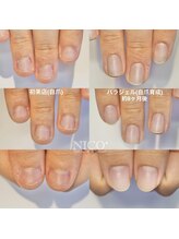 ニコプラス(NICO+)/自爪育成中