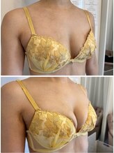 エスビューティー 三軒茶屋(S beauty)/最大３カップバストアップ