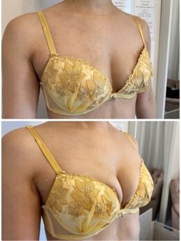 エスビューティー 三軒茶屋(S beauty)/最大３カップバストアップ