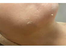 メンズブリリアンス/ターンオーバーを正常に★