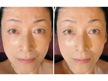 ル キヤ アイスペシャリテ ハービスENT店/【超音波保湿ケア】ふっくら美肌