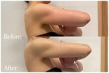 ボディヒーリングアンド小顔美容矯正 プララン