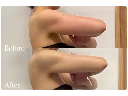 ボディヒーリングアンド小顔美容矯正 プラランの写真